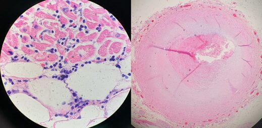 Tissue under microscope